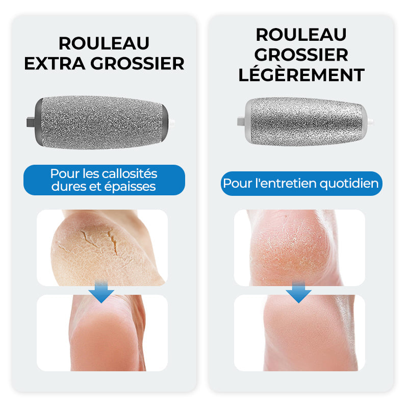 🌸Fête des mères vente chaude 50% RÉDUCTION 🌸Extracteur de callosités électrique pour les pieds