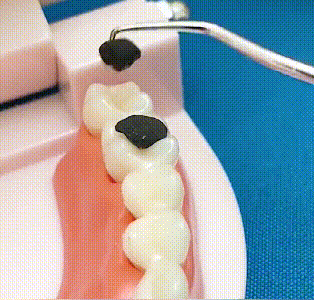 ⚡ Set de cure-dents en acier inoxydable | Hygiénique & Durable 🦷✅
