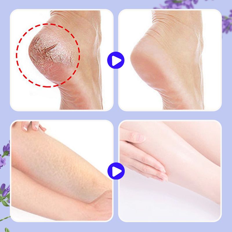 🏆Baume nourrissant réparateur pour les pieds anti-crevasses✨🌿
