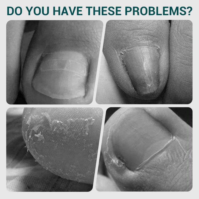Coupe-ongles professionnel à ressort angulaire✂️💅