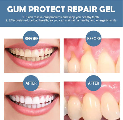 Yellow📢📢 50 % de réduction !!⏰ Gel réparateur pour la protection des gencives 🦷