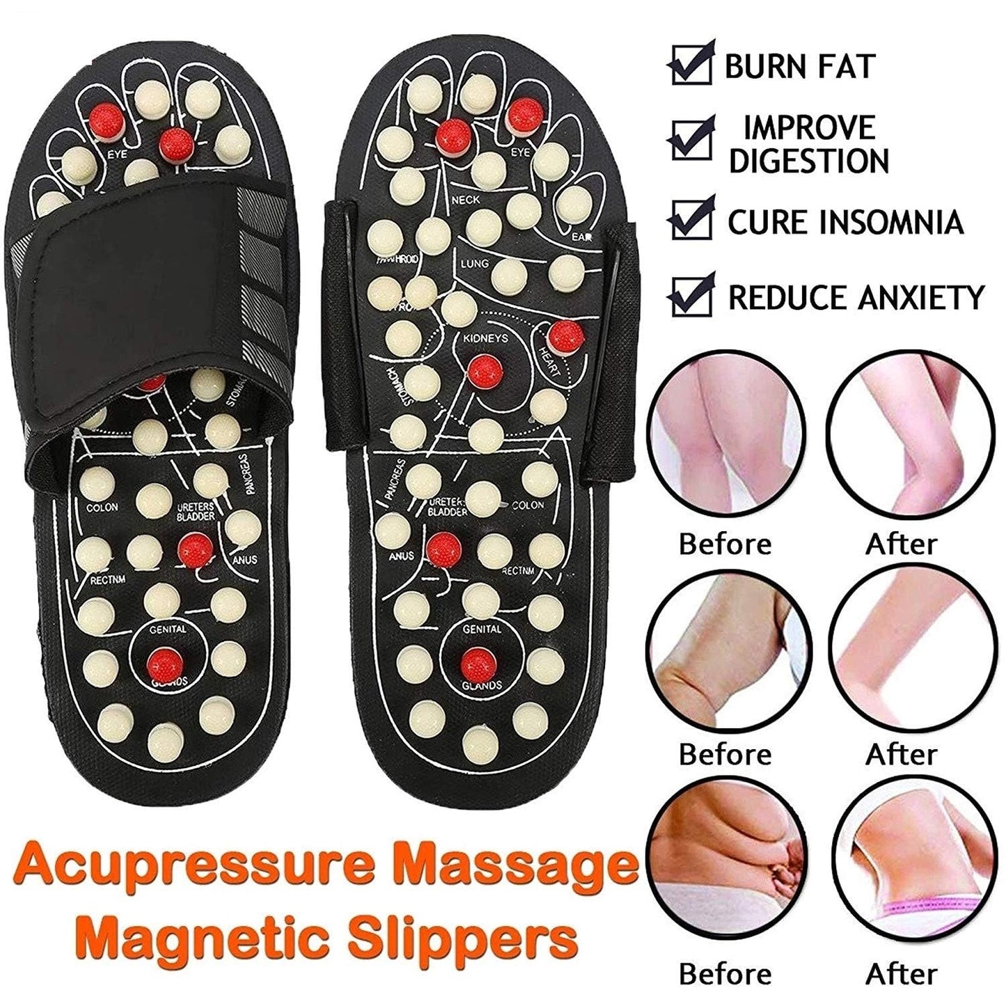 Chaussons d'acupression et de magnétothérapie 🔥50 % DE RÉDUCTION !🔥