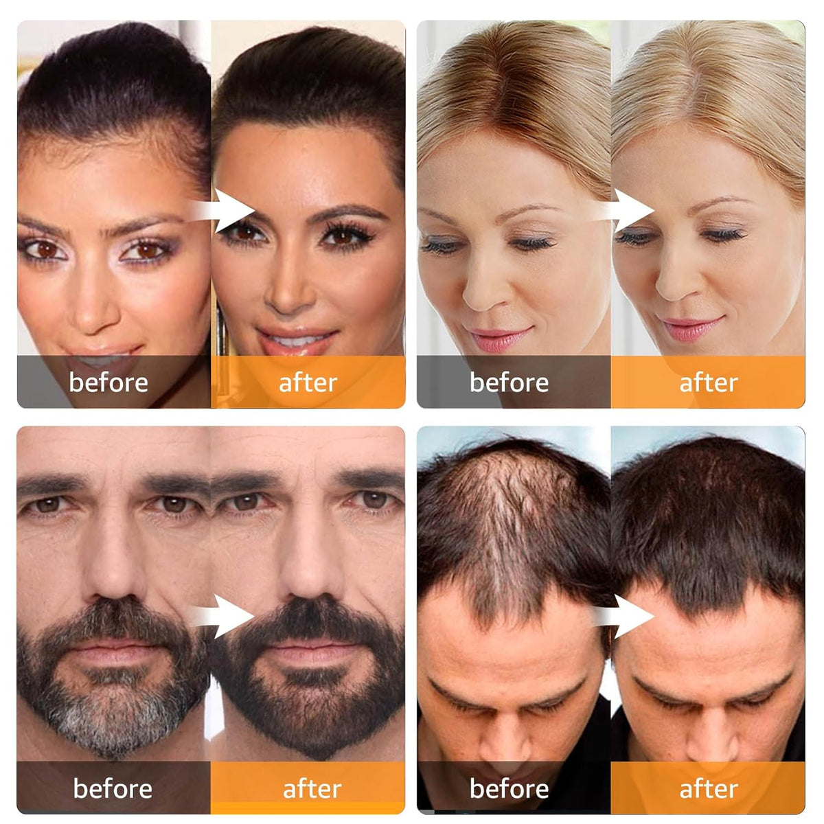 Dernier jour : 50 % de réduction 🎉 Un correcteur de racines pour une beauté sans effort