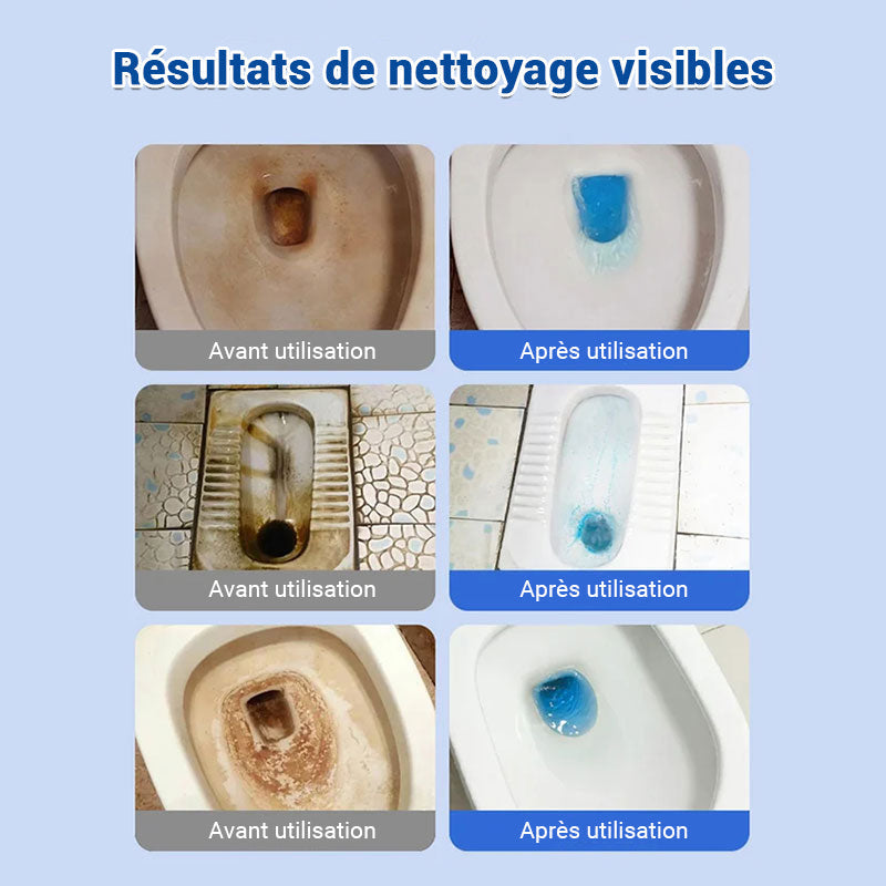 Comprimés effervescents de nettoyage des toilettes - décontamination, tartre urinaire, alcali urinaire et élimination des odeurs