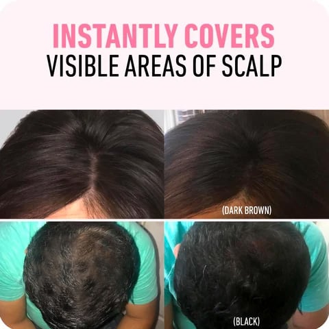 Dernier jour : 50 % de réduction 🎉 Un correcteur de racines pour une beauté sans effort