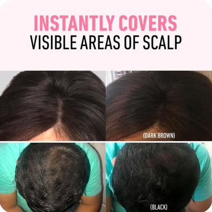 Dernier jour : 50 % de réduction 🎉 Un correcteur de racines pour une beauté sans effort