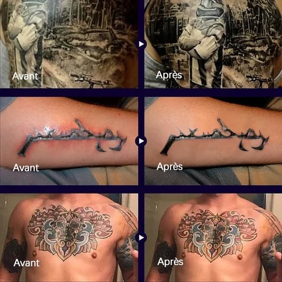 🔥 Baume Après-Soin Éclaircissant pour Tatouage