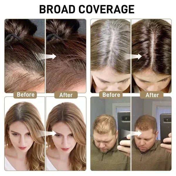 Dernier jour : 50 % de réduction 🎉 Un correcteur de racines pour une beauté sans effort