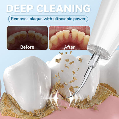 Nettoyeur dentaire à ultrasons intelligent pour les dents
