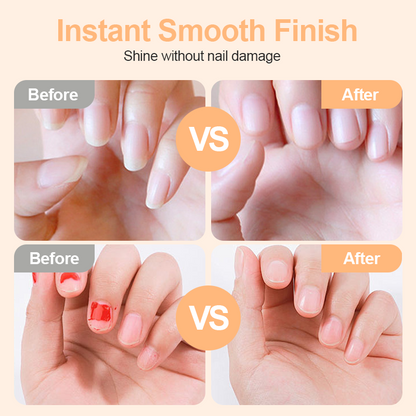 🌟 Coupe-ongles et polisseur électrique intelligent 2-en-1 ✂️💅