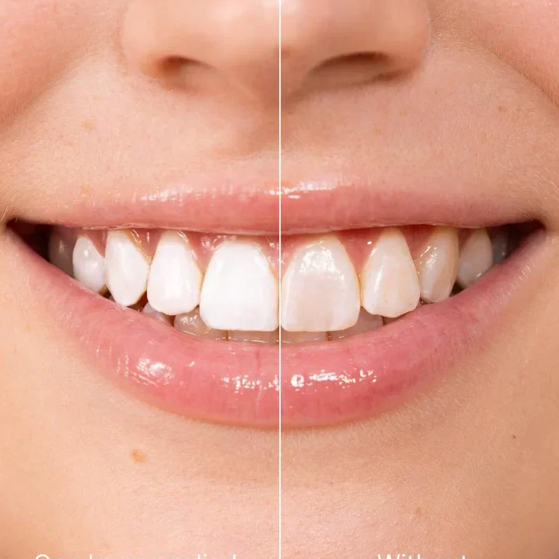 📢📢Achetez-en 5, obtenez-en 5 gratuits ⏰Teinture blanchissante instantanée pour les dents, 5 ml