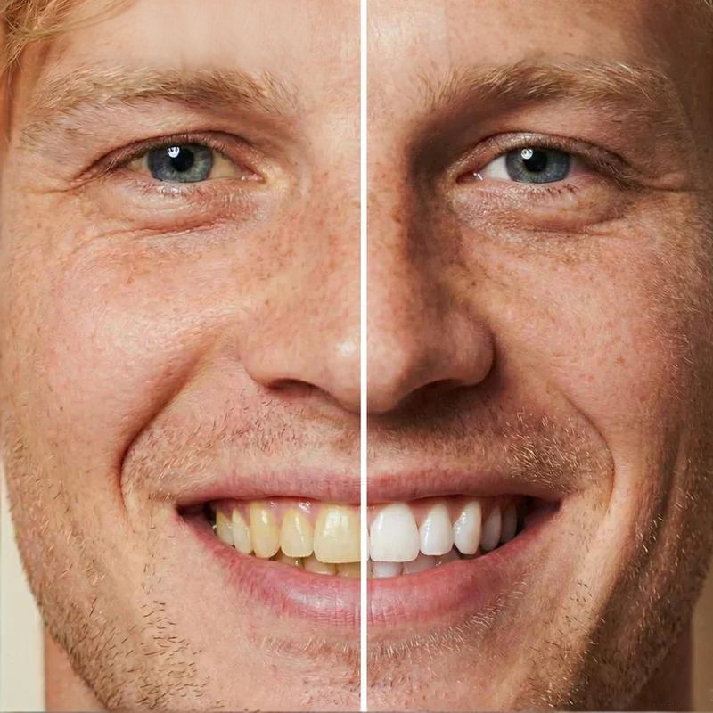 📢📢Achetez-en 5, obtenez-en 5 gratuits ⏰Teinture blanchissante instantanée pour les dents, 5 ml