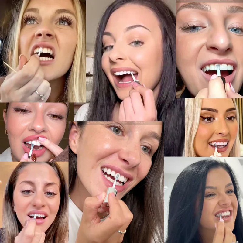 📢📢Achetez-en 5, obtenez-en 5 gratuits ⏰Teinture blanchissante instantanée pour les dents, 5 ml