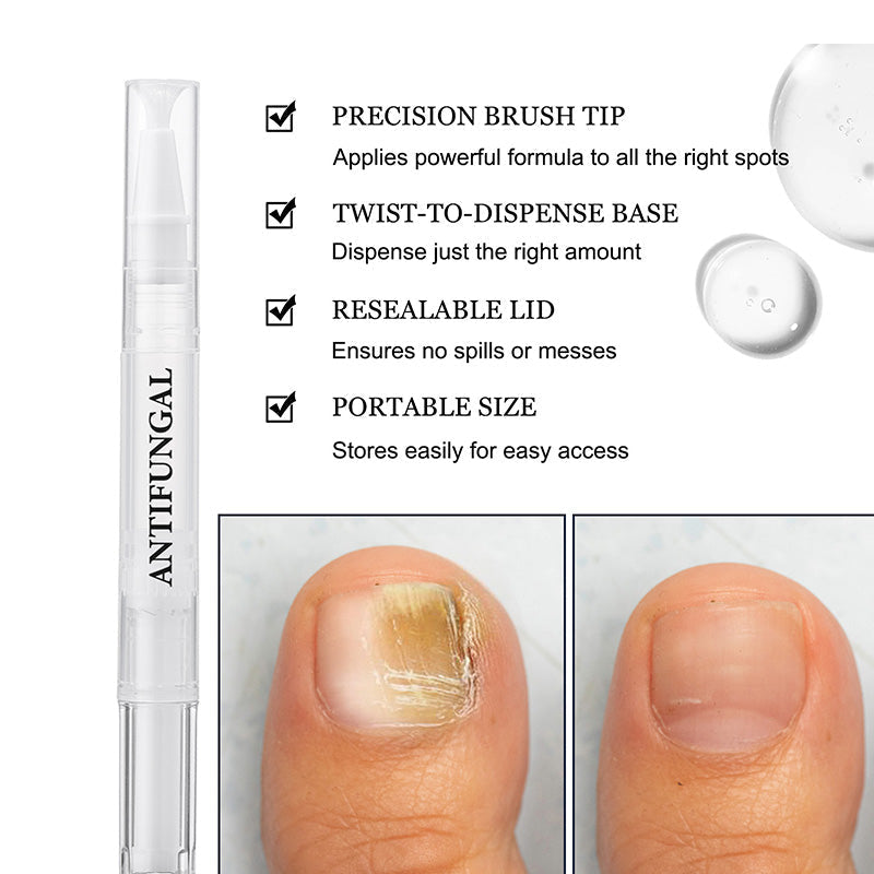 ✨Nouveautés🔥Stylo de traitement contre les champignons des ongles des pieds pour les ongles endommagés