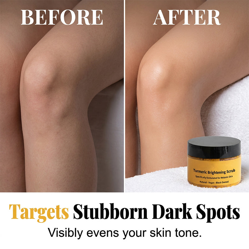 🔥2 achetés, le 3e offert🔥Gommage corporel exfoliant au curcum