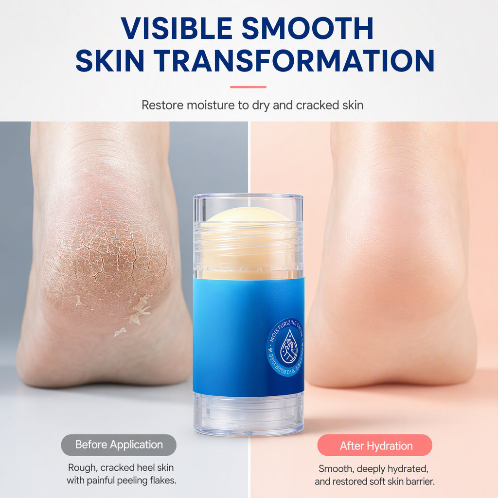 🔥OFFRE ÉCLATANTE🔥 Stick hydratant au gel de pétrole – Squalane et acide hyaluronique, application sans les mains – Pour les mains, les pieds et les talons secs – Pêche ou orange – 35 g ! 🧴✨